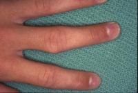 Click for larger image