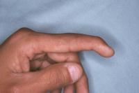 Click for larger image