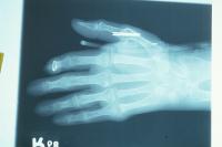 Click for larger image