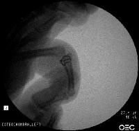 Click for larger image