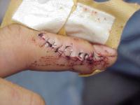 Click for larger image