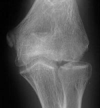 Click for larger image