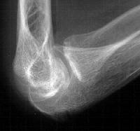 Click for larger image