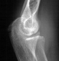 Click for larger image