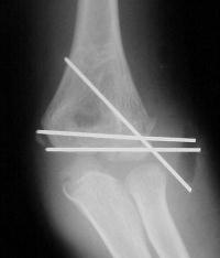 Click for larger image