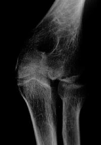 Click for larger image