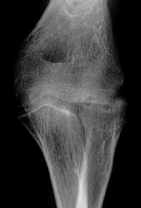 Click for larger image