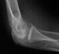 Click for larger image