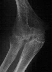 Click for larger image