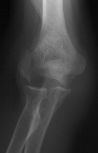 Click for larger image