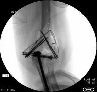 Click for larger image