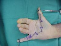 Click for larger image