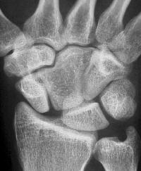 Click for larger image