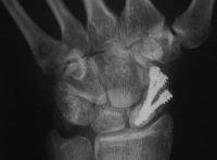 Click for larger image