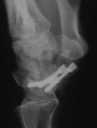 Click for larger image