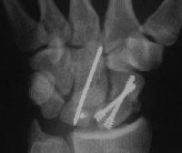 Click for larger image