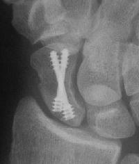 Click for larger image