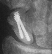 Click for larger image