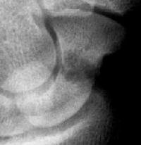 Click for larger image