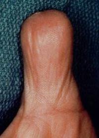 Click for larger image