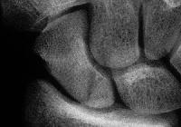 Click for larger image