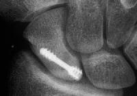 Click for larger image