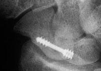 Click for larger image