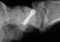 Click for larger image