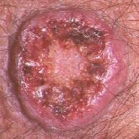 Click for larger image